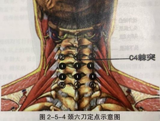 合七中在哪个位置示意图(颈七在哪个位置示意图)-图2 合七中在哪个位置示意图(颈七在哪个位置示意图)-图2