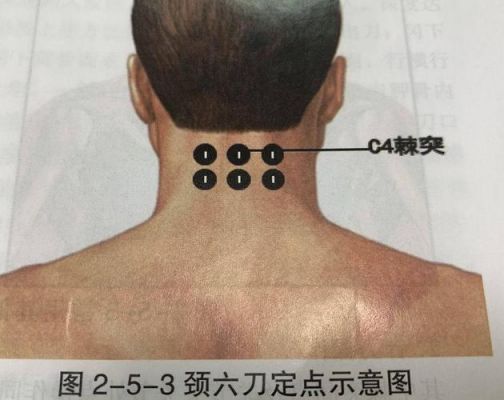 合七中在哪个位置示意图(颈七在哪个位置示意图)-图3 合七中在哪个位置示意图(颈七在哪个位置示意图)-图3