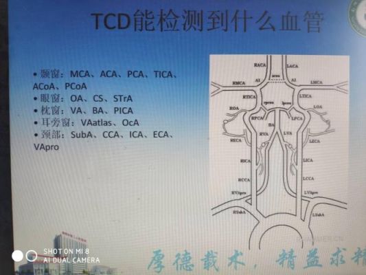 tcd哪个国家（tcd全称）