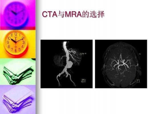 mra和cta哪个确诊率高（cta和mra哪个好）