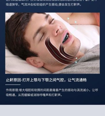 止鼾设备nora(止鼾器推荐)-图3 止鼾设备nora(止鼾器推荐)-图3