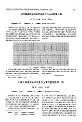 ce传导干扰标准(传导干扰分为)-图3 ce传导干扰标准(传导干扰分为)-图3