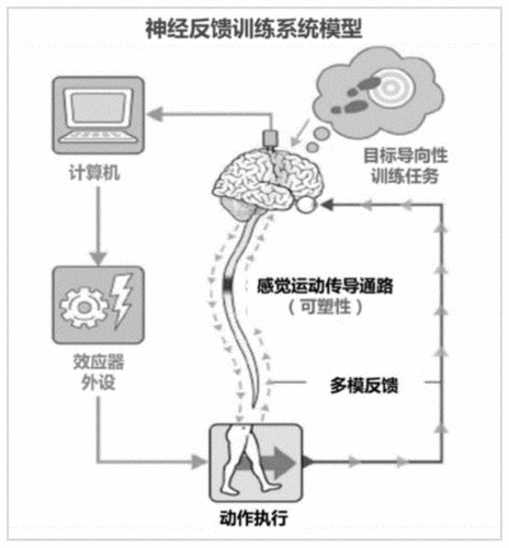 神经反馈设备（神经反馈训练去哪里做）