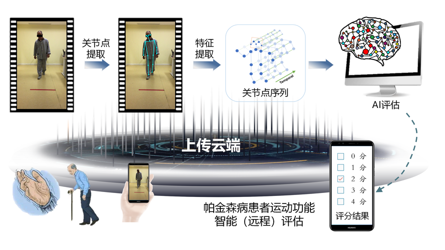 帕金森智能设备(帕金森智能设备厂家)-图1 帕金森智能设备(帕金森智能设备厂家)-图1