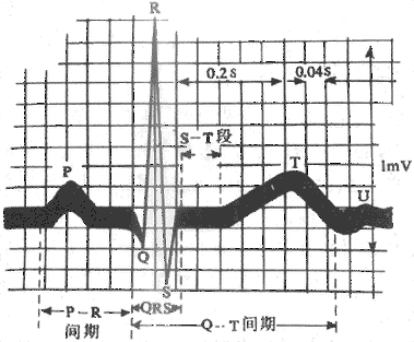 标准心电信号模式图（标准心电图图片）